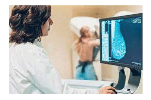 Estudios mamograficos